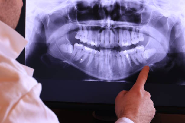 Best Emergency Dental Surgery in Taylorsville, NC