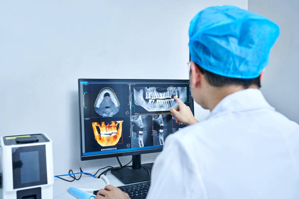 Best Emergency Wisdom Teeth Removal in Taylorsville, NC