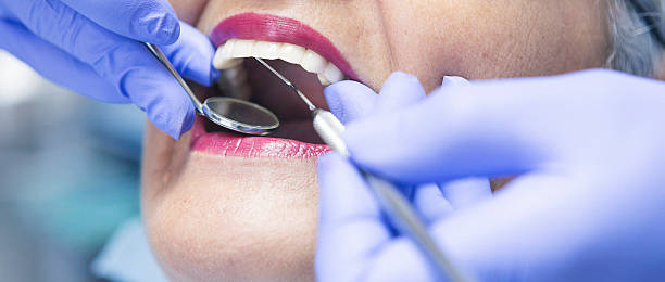 Best Emergency Tooth Extraction in Taylorsville, NC